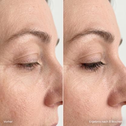 Multi-Peptid Wimpernserum