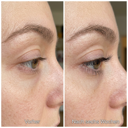 Multi-Peptid Wimpernserum
